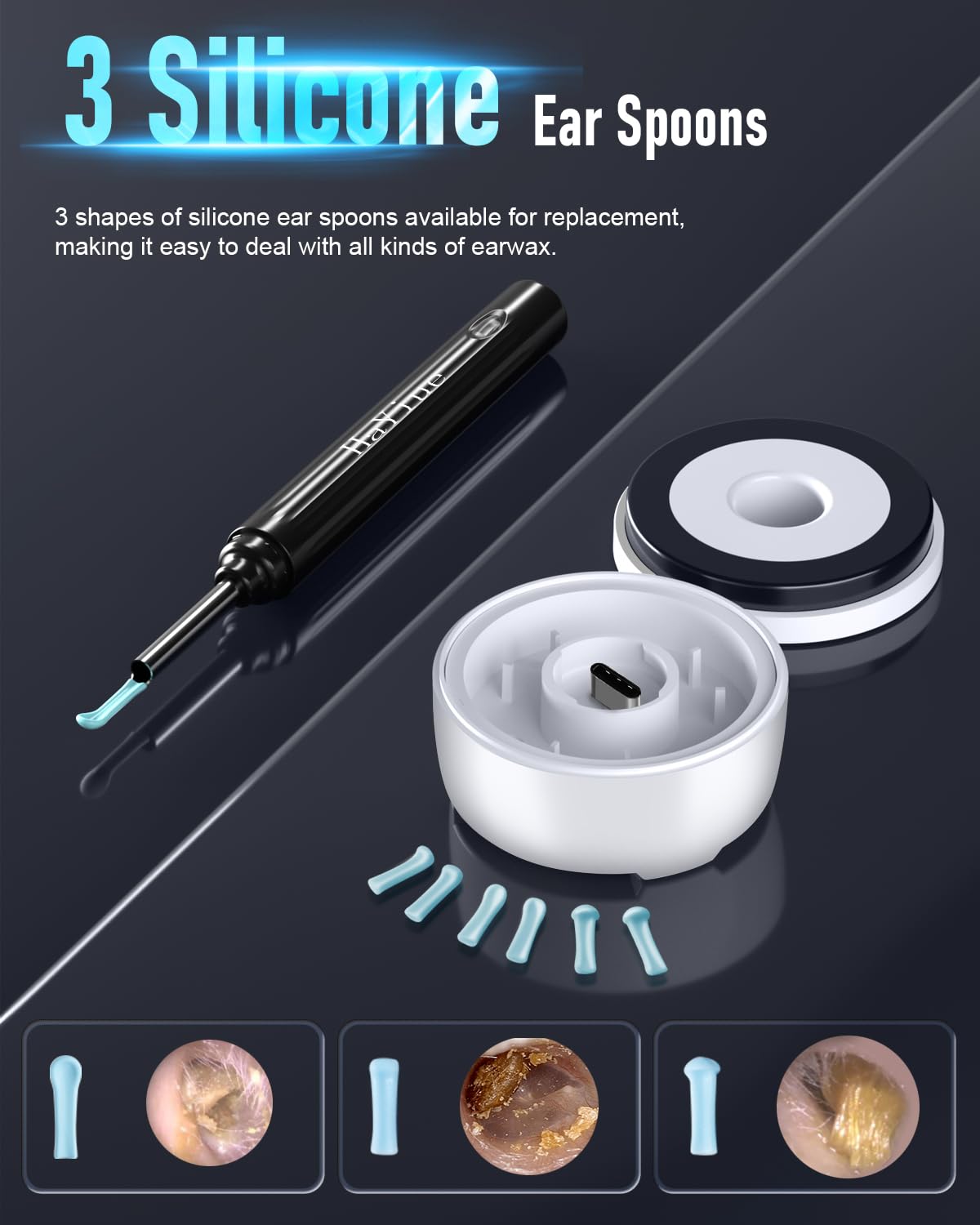 Smart Visual Ear Cleaner with 1296P HD Camera & WiFi Connectivity – Ultra-Slim Ear Wax Removal Tool with LED Lights & USB Rechargeable Design