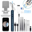 Smart HD Ear Wax Removal Tool with Wireless Camera & LED Illumination – Rechargeable Visual Ear Cleaner for Safe and Precise Ear Care (Blue Edition)