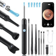 Loyker X6 Ear Wax Removal Tool with 1080P HD Camera, 360° View Otoscope, 6 LED Lights, and Rechargeable Waterproof Ear Cleaner
