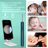 Smart HD Ear Wax Removal Tool with Wireless Camera & LED Illumination – Rechargeable Visual Ear Cleaner for Safe and Precise Ear Care (Blue Edition)