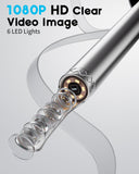 Loyker X6 Ear Wax Removal Tool with 1080P HD Camera, 360° View Otoscope, 6 LED Lights, and Rechargeable Waterproof Ear Cleaner