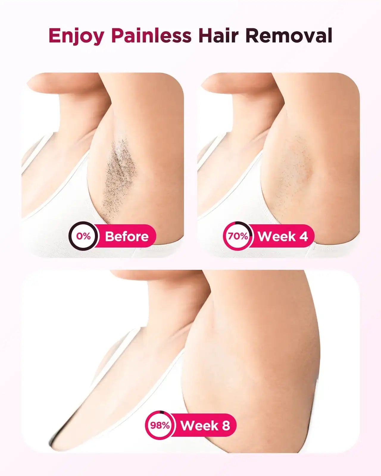 990000 Flash Laser Epilator – IPL Hair Removal Machine for Body, Bikini & Face (Men & Women)